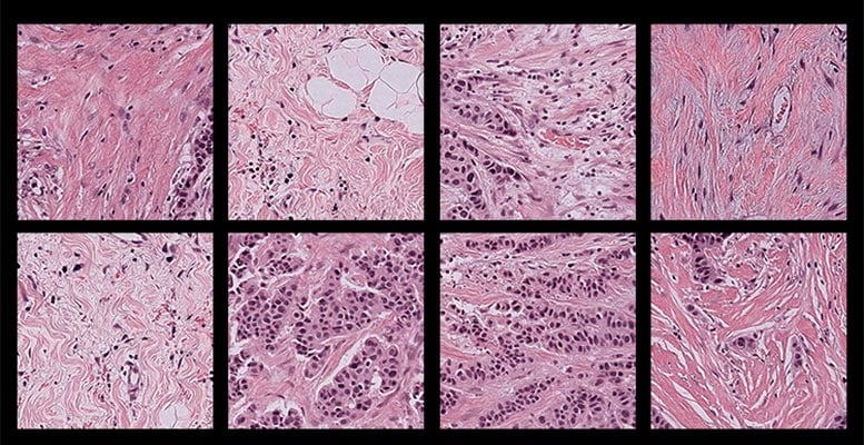 Pathology Human Tissue Samples