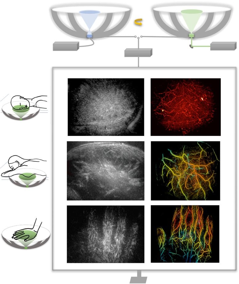 Bringing Optical Color to Ultrasound Graphic